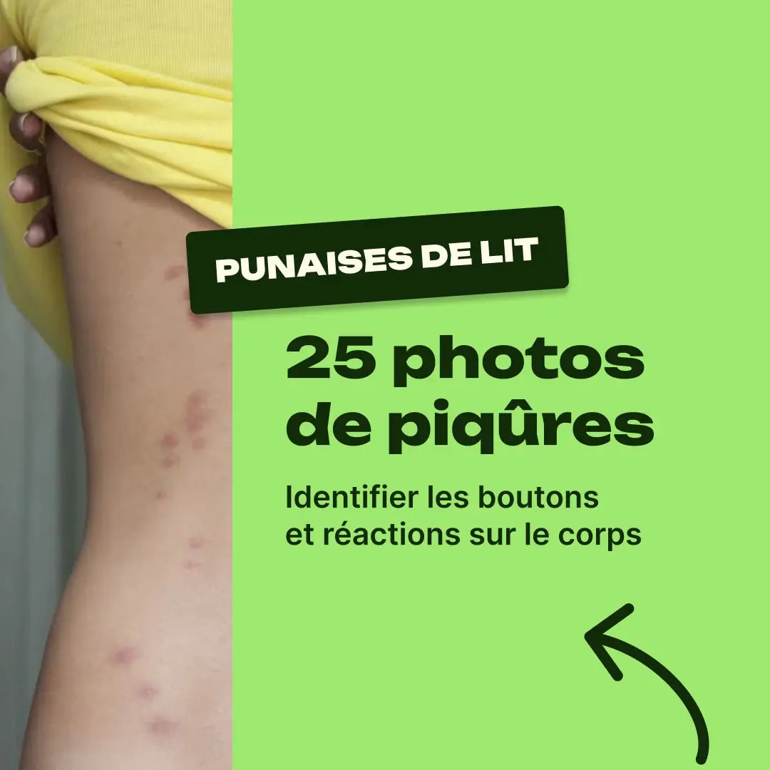 punaise de lit piqure photo