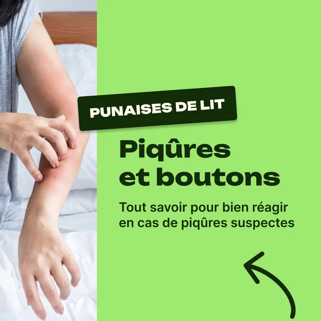piqûre de punaise de lit
