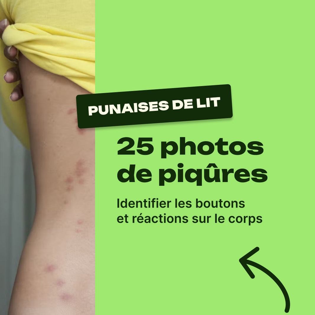 punaise de lit piqure photo