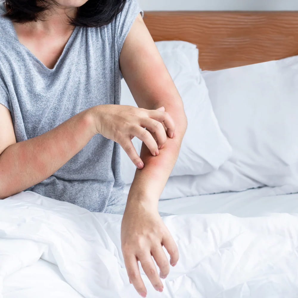 avantages des pièges punaise de lit